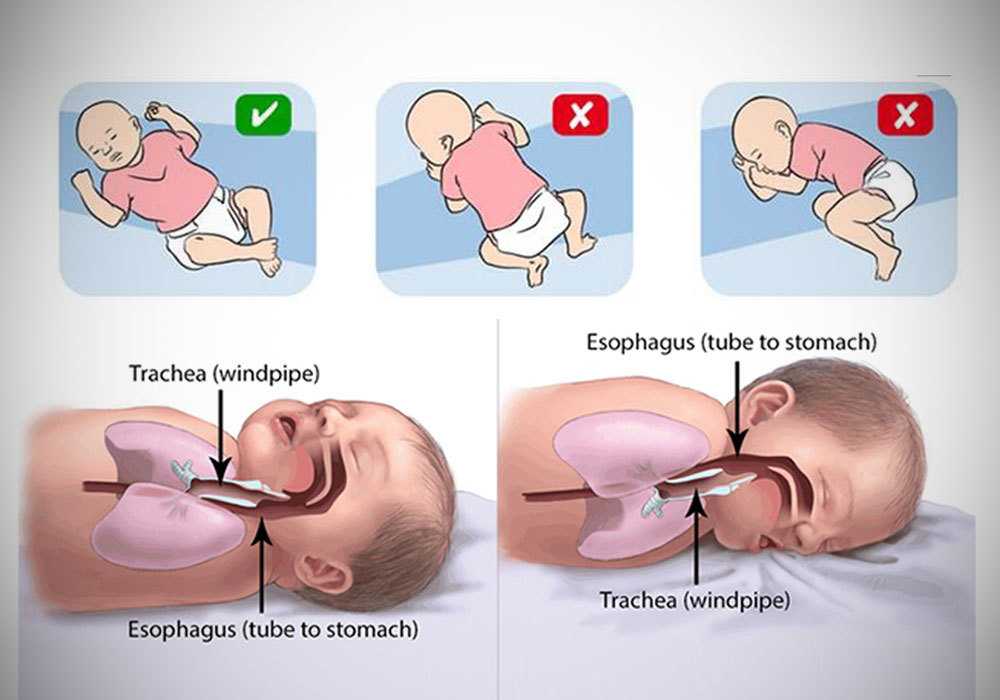 SIDS-6-Important-Facts-and-Ways-for-Parents-to-Avoid-It.jpg