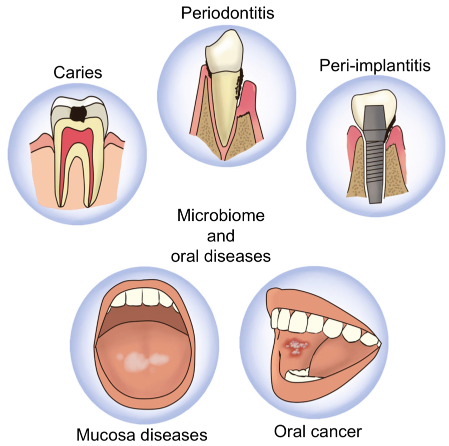 oral-microbiome-disease.png